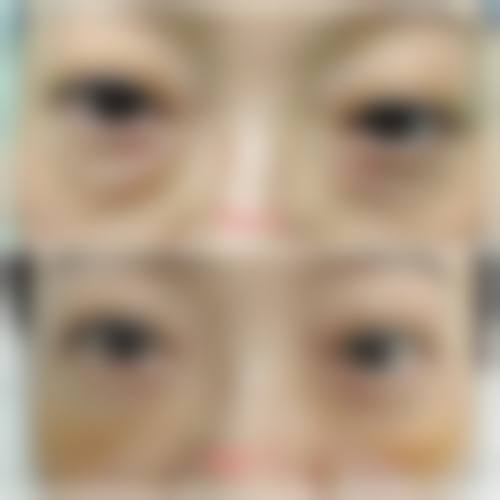 四、昭通爱丽诺整形美容医院特色项目