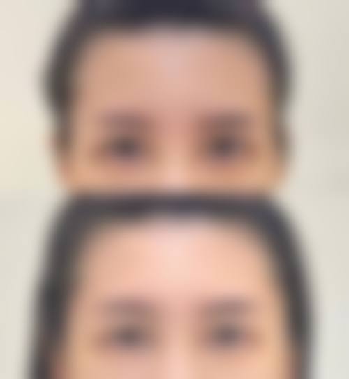 八、昭通爱丽诺整形美容医院真实的患者评价