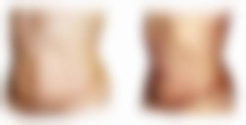 一、审美观念影响下女人为什么喜欢隆胸