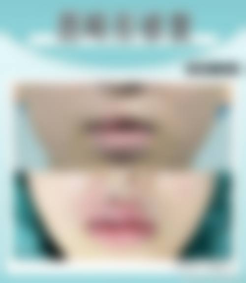 八、东营医联美医疗美容门诊部真实的患者评价