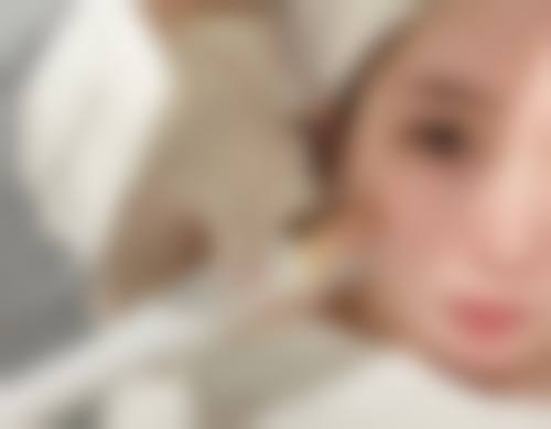 三、再次做假体隆胸的注意事项