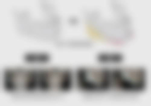 一、茶叶包去眼袋的原理及方法