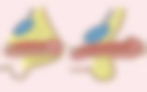 五、总结：喜辽妥软膏能去眼袋吗？