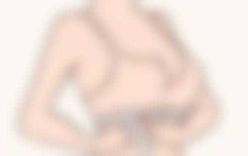 三、吸眼袋后的修复阶段