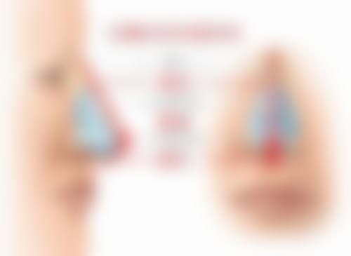 五、割个双眼皮后多久能做其他事情