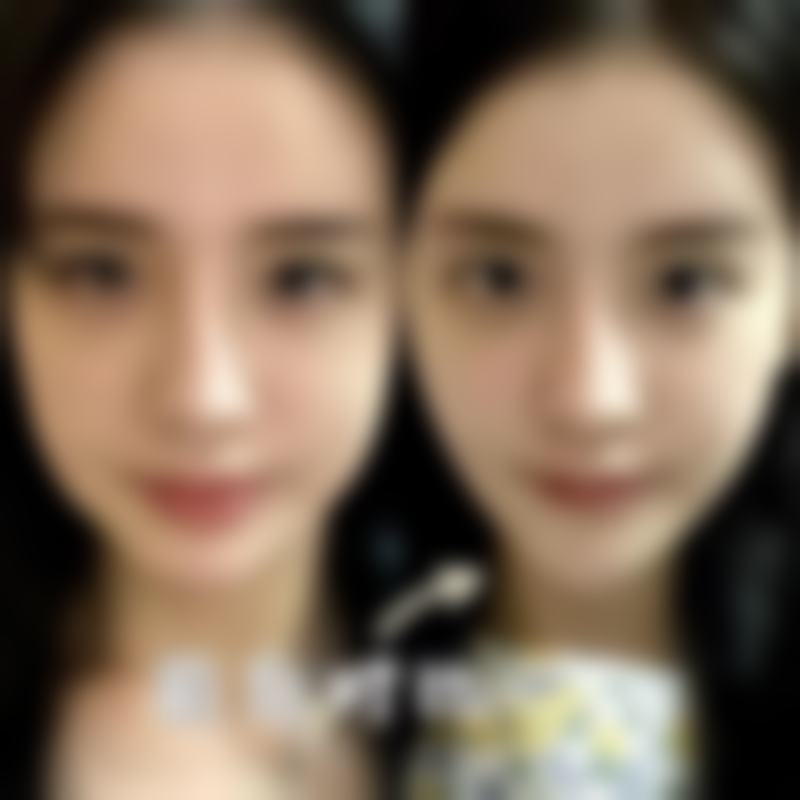 一、牙膏可以去眼袋吗？深入探究牙膏成分与眼袋成因