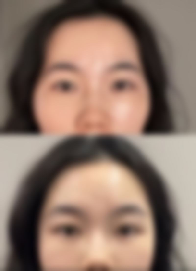 四、广东梅州美莱美医疗美容特色项目