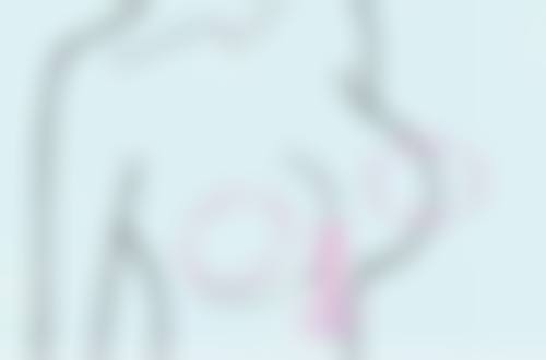五、脸上有缝针疤痕修复后的护理