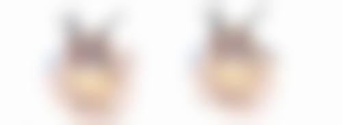 五、疤痕疙瘩怎么样治疗更好?总结