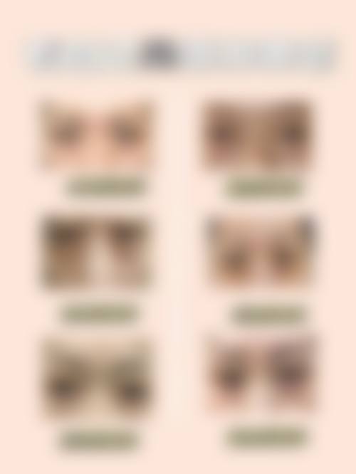 九、兰州市妇幼保健院医学整形美容科真实的患者评价