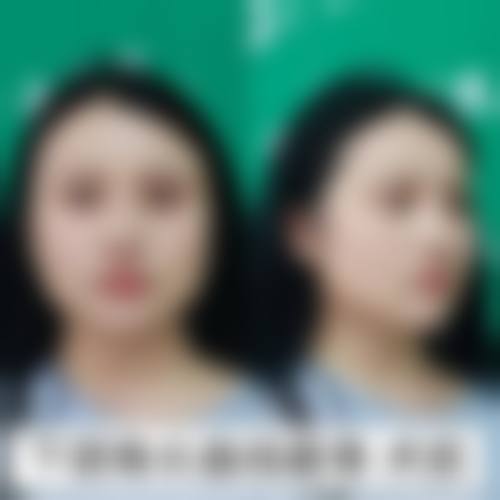 三、曲阳星灿整形医院诊疗项目有哪些?