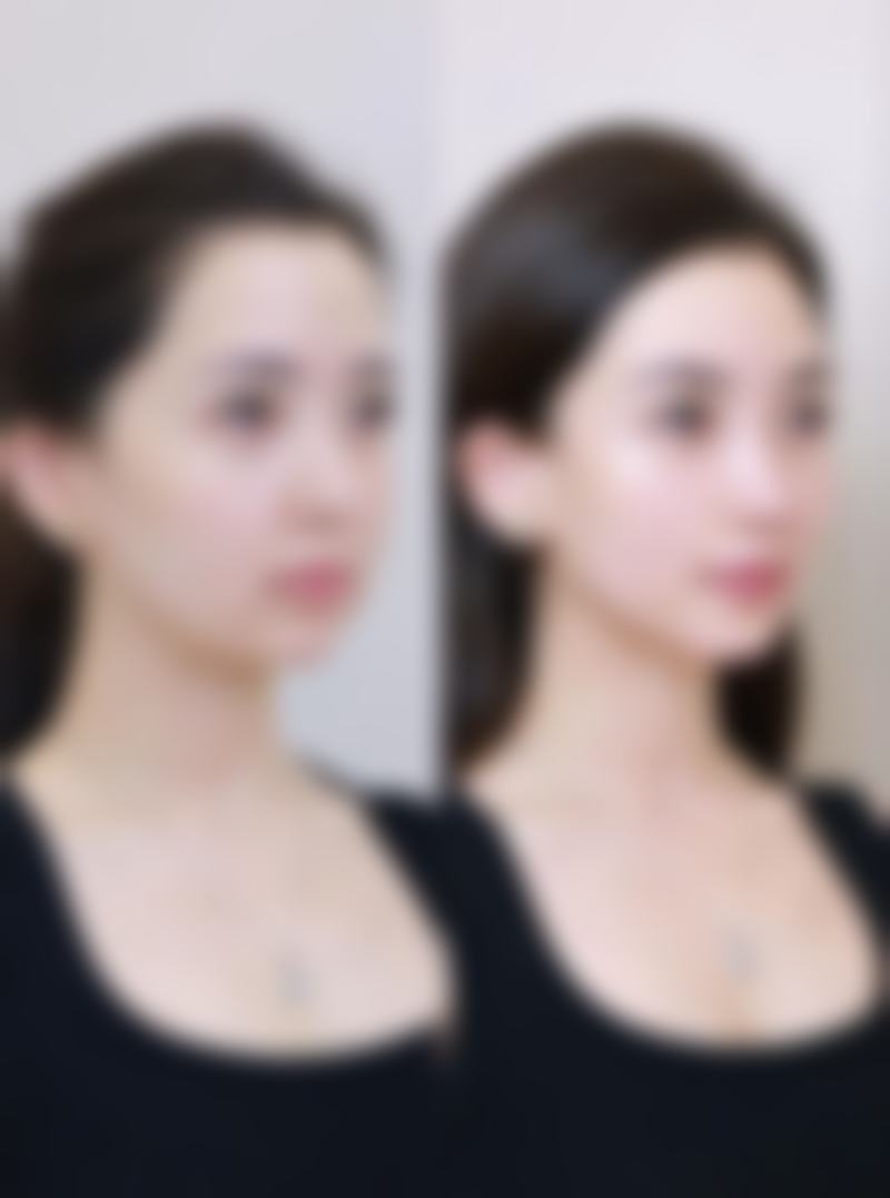 二、兰州市妇幼保健院医学整形美容科怎么样?