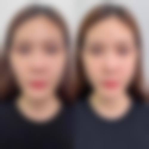 九、江苏连云港时光盛美美容诊所真实的患者评价