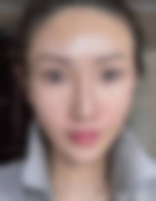 四、枣庄美之道医疗美容门诊部特色项目