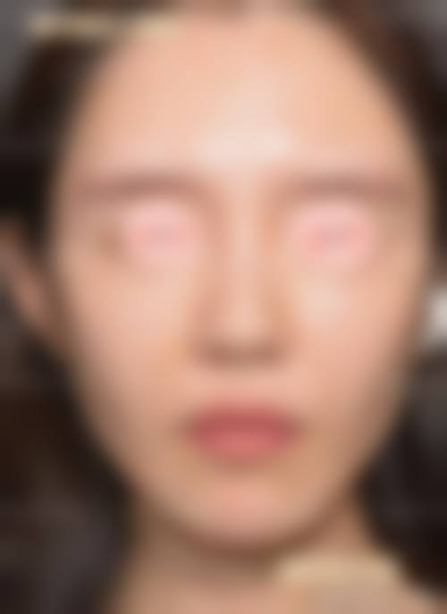 三、韩国爱宝(Everm)整形医院诊疗项目有哪些?