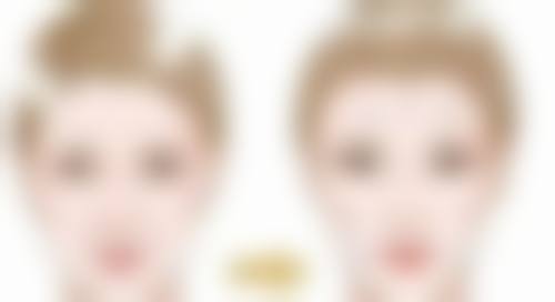 五、14岁去眼袋的注意事项