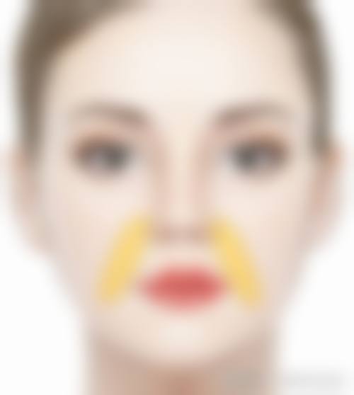 一、抽脂填胸的操作原理