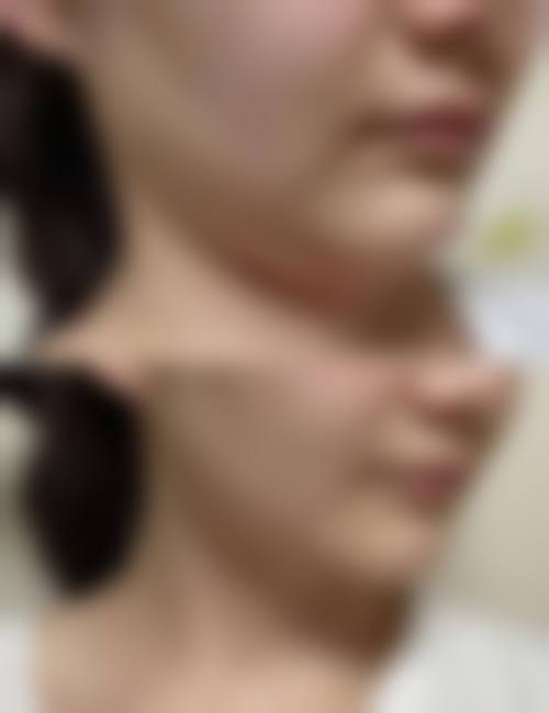 八、包头馨音港丽医疗美容诊所真实的患者评价