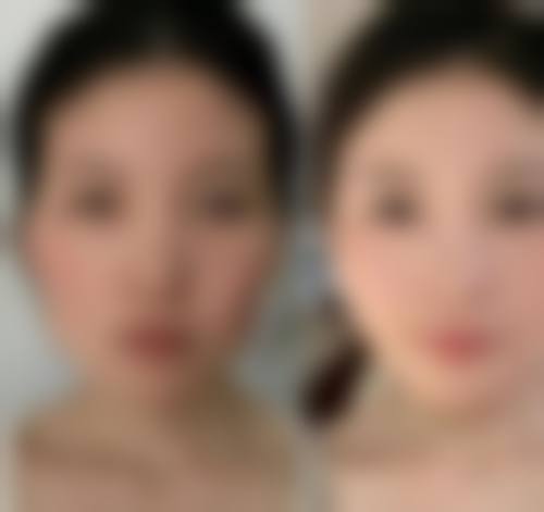 二、长沙芯美昕医疗美容门诊部怎么样?