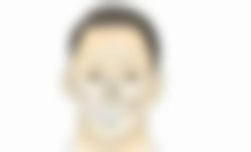 五、尝试激光治疗避免疤痕增生