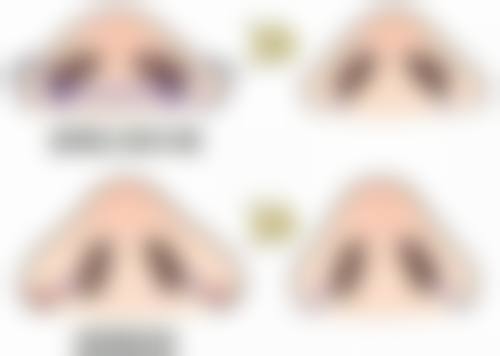三、鼻子的疤痕怎么去之手术治疗