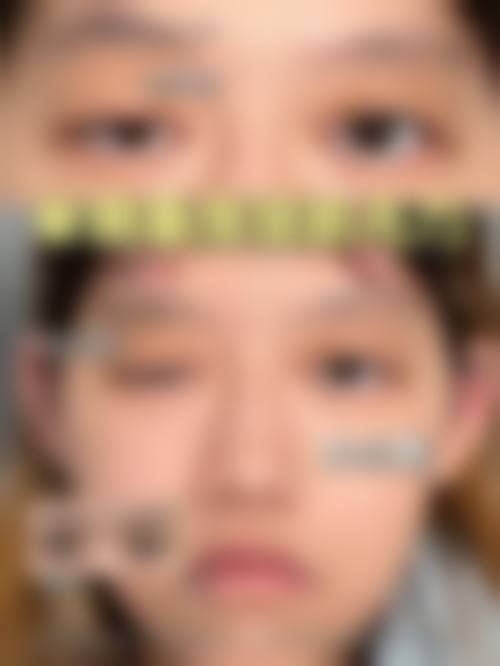 四、银川崔大夫博士丽整形医疗美容门诊部特色项目