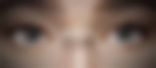 三、一般疤痕治疗之手术治疗