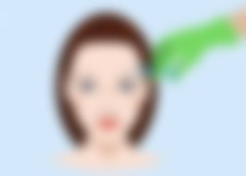 五、治疗疤痕的注意事项