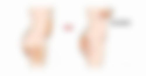 二、全切双眼皮术后输液的情况分析