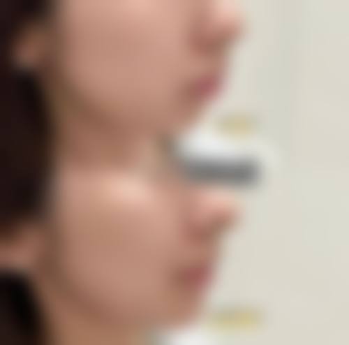 六、韩国心动Sulleim整形外科价格表