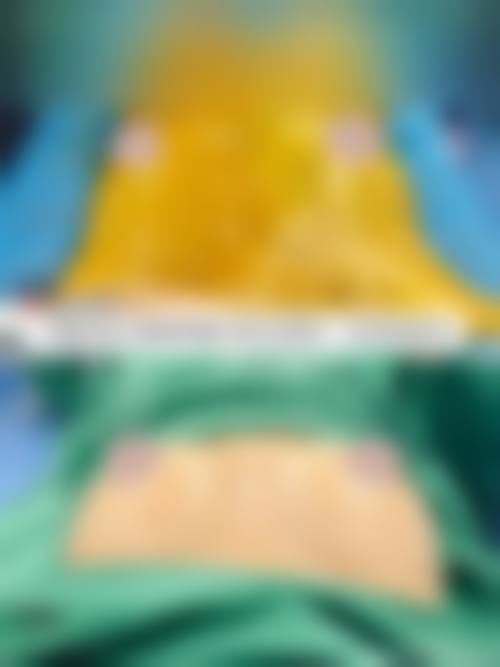 八、天长恒美医疗美容门诊部真实的患者评价