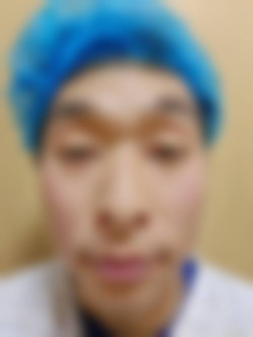 优惠活动详情
