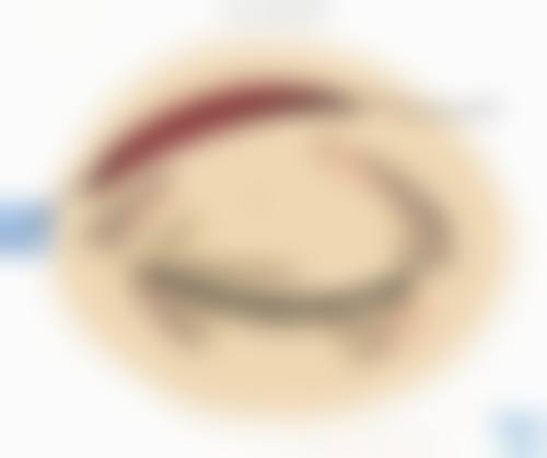 临床实例分享
