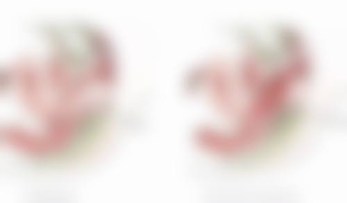 六、假体隆胸260cc的价格参考
