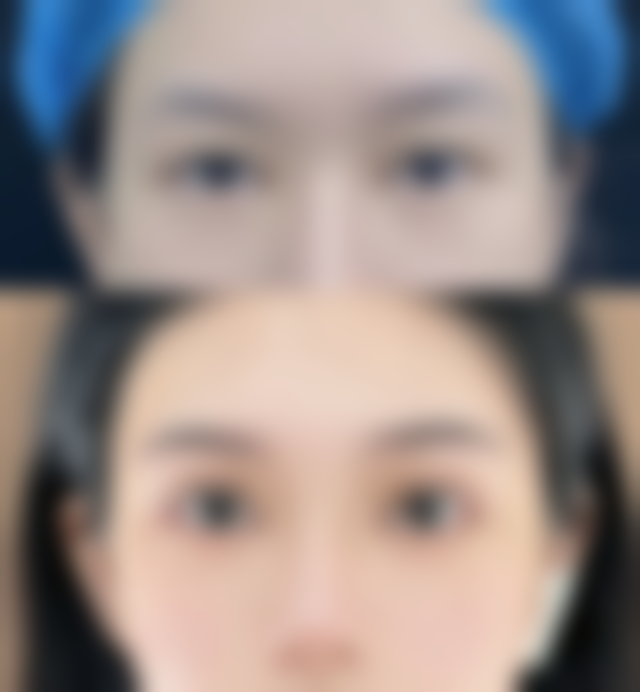 九、无锡美呈医疗美容门诊部真实的患者评价