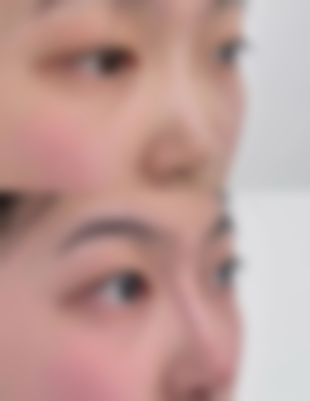 三、从审美多元化角度看男生割双眼皮