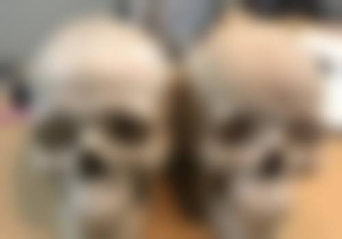 一、了解眼袋成因与去眼袋的重要性