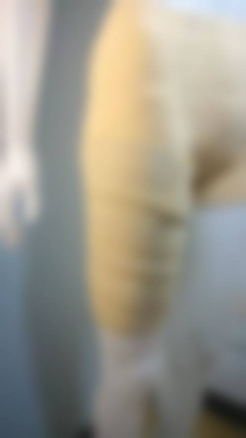 八、武汉中爱整形美容门诊部真实的患者评价