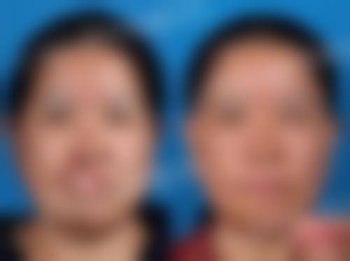 二、武汉中爱整形美容门诊部怎么样?