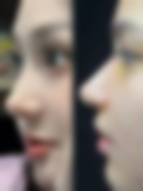 五、北京泰妃整形医疗美容诊所价格表