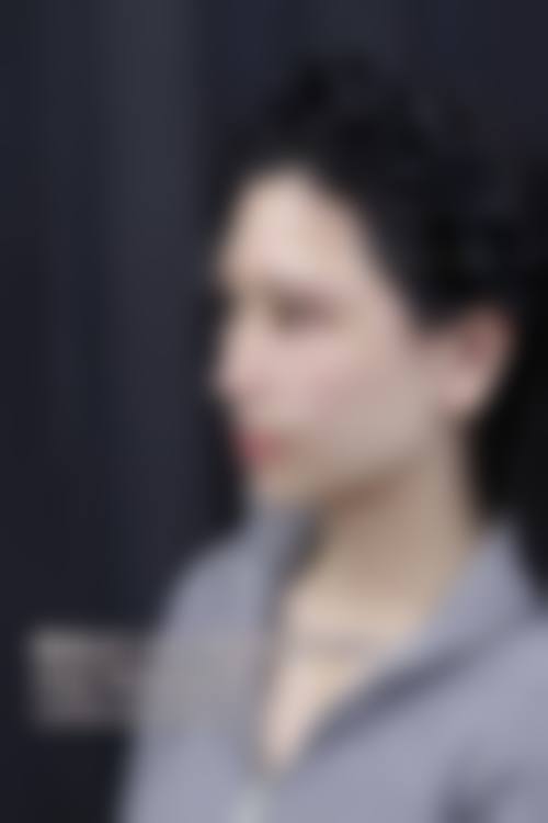 八、北京泰妃整形医疗美容诊所真实的患者评价