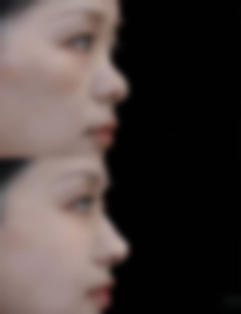 一、认识疤痕黑色素