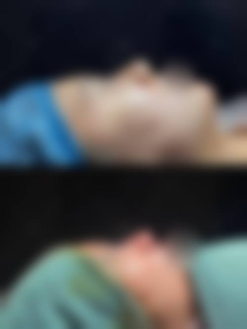 九、东莞君熠医疗美容整形医院真实的患者评价
