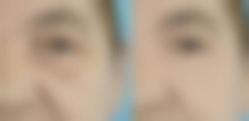 四、东莞君熠医疗美容整形医院特色项目