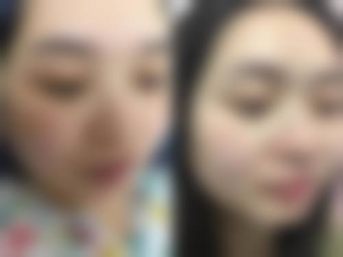 六、张倩倩真实的患者评价