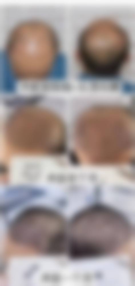 二、河北大学附属医院整形科怎么样?