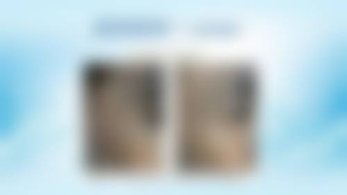 五、河北大学附属医院整形科价格表