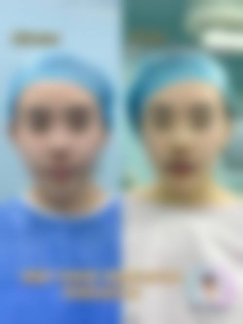 七、河北大学附属医院整形科预约方式