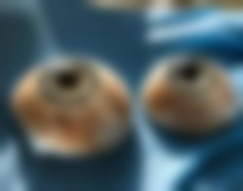 特色科室与项目:覆盖常见眼病,满足多样需求