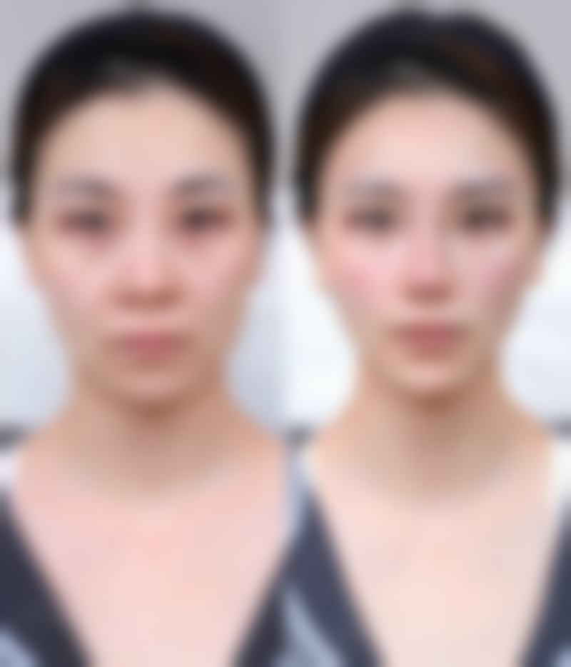 二、草莓苗秋季9 - 10月种植要点